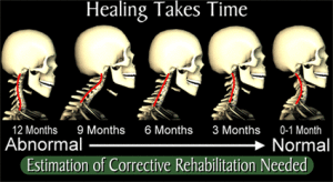 cervical_curve_poster2c
